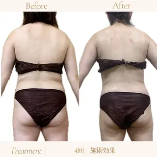 coco salon sou.所属・佐藤 由依のエステ・リラクイメージ