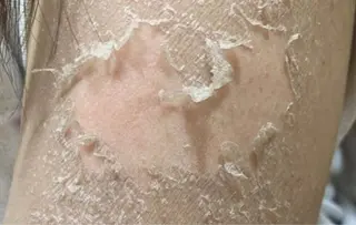 ☺ハーブピール💕 ソフィアカロン💖のエステ・リラクイメージ