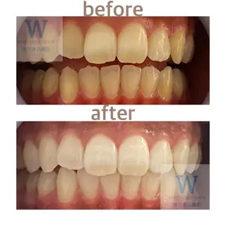 ホワイトニング ショップ本八幡店のエステ・リラクイメージ