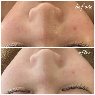 メンズ メナード岐阜茜部 杉浦のエステ・リラクイメージ