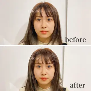 はり灸サロン　totonoi所属・筋膜リリース 小顔美容鍼のエステ・リラクイメージ