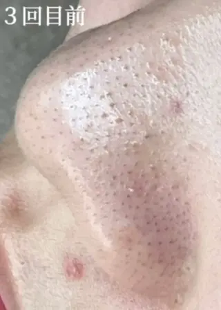 毛穴ケア専門サロン Yourmeユアミーのエステ・リラクイメージ