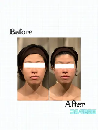 小顔整体美容を科学する【小顔FaceLabo.】横浜店所属・小顔FaceLabo 横浜店  篠原のエステ・リラクイメージ