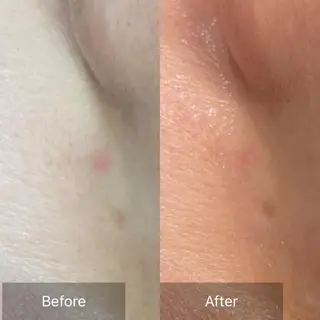 産毛専門店 Bittoのエステ・リラクイメージ