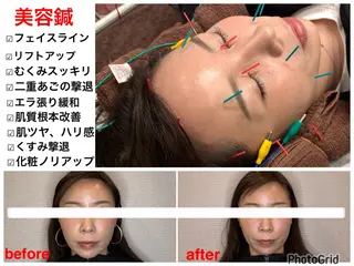 小林整骨院本町 美容鍼roomのエステ・リラクイメージ