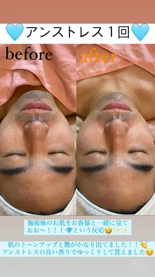 メンズ Salon de Lino 御器所のエステ・リラクイメージ