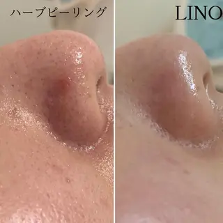 beautysalon  LINO所属・平日限定！お得！ 全メニュ¥5,500のエステ・リラクイメージ