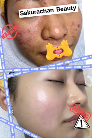 ニキビ、痩身、脱毛、 サクラチャンスパのエステ・リラクイメージ