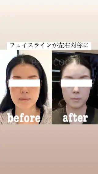 小顔と ヘッドスパのお店のエステ・リラクイメージ