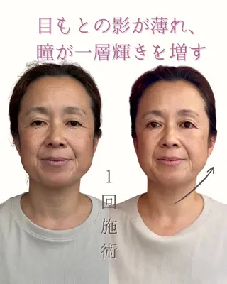 麻布十番/圧倒的小顔 🐷毒だし美容鍼灸のエステ・リラクイメージ