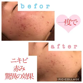 セミロング カラー パーマ ヘアアレンジ メンズ キッズ ネイル マツエク・マツパ 四つ星サロン🎖 腸＆ニキビケアに特化のエステ・リラクイメージ