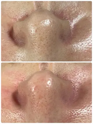 エステ／ネイル/脱毛 R.Msalonのネイルデザイン