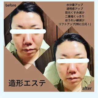 ミューズエステ 谷口美結のエステ・リラクイメージ