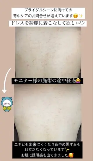 ベラージュ【美背中・ 美尻・フェイシャル】のエステ・リラクイメージ