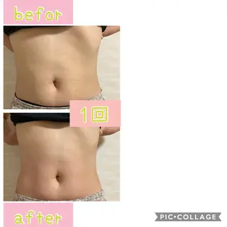 癒し腸もみサロン シャユーム　ゆきなのエステ・リラクイメージ