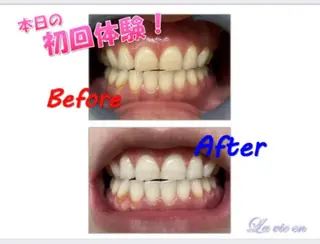 セルフホワイトニングサロン　ラヴィアン所属・ホワイトニングサロン La vie enのその他イメージ