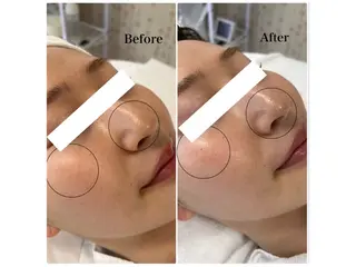 Astorie 相模大野エステのその他イメージ