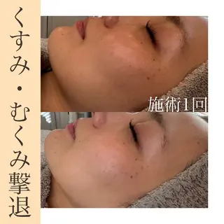 eim yukinaのエステ・リラクイメージ