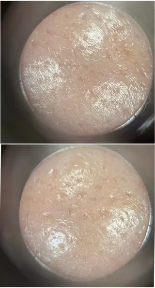 メナード伊勢崎宮子西店所属・メナード伊勢崎 宮子西erinaのエステ・リラクイメージ