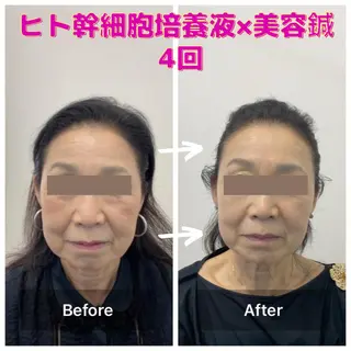 gomi sayakaのエステ・リラクイメージ