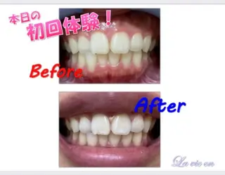 セルフホワイトニングサロン　ラヴィアン所属・ホワイトニングサロン La vie enのその他イメージ