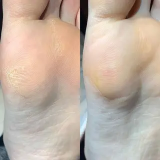 ネイル ROUN'　南 鈴沙のネイルデザイン