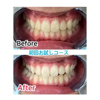 プラチナムビューティー柏所属・【歯科提携】柏ホワイ トニングスタイルのその他イメージ