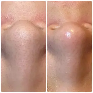 salon akua nail＆リラクのマツエク・マツパデザイン