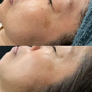 LiZA エステティックサロンのエステ・リラクイメージ