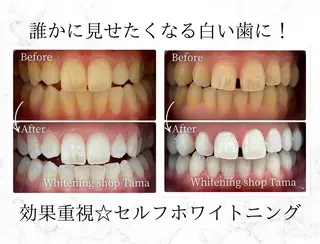 ホワイトニング ショップ多摩店のその他イメージ