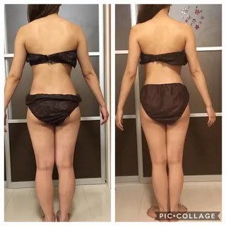 セミロング カラー パーマ ヘアアレンジ メンズ キッズ ネイル マツエク・マツパ アニメ,Vオタク× 即効痩せエステサロンのエステ・リラクイメージ