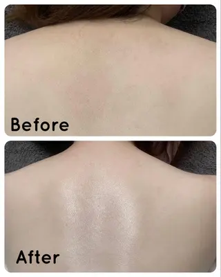 SnowWhite美肌ピーリングサロン所属・Snow Whiteのエステ・リラクイメージ