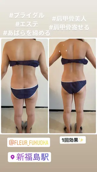 FLEUR大阪・整体 ・ハイフ・痩身・小顔のエステ・リラクイメージ