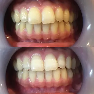 LBSホワイトニング 新宿店💝店長熊倉のその他イメージ