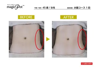 心斎橋痩身ダイエット 韓国.美容鍼.小顔のエステ・リラクイメージ