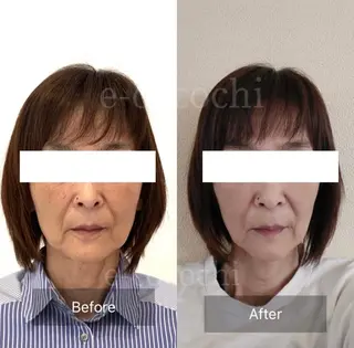 小顔と ヘッドスパのお店のエステ・リラクイメージ