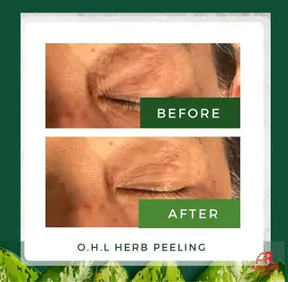 Liam《美肌管理/ 3D小顔/脂肪ケア》のその他イメージ