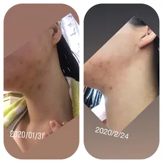 【足圧】鬼👹リンパ 身体整うサロンのエステ・リラクイメージ