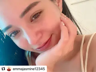 肌質改善 KALANCHOEのエステ・リラクイメージ