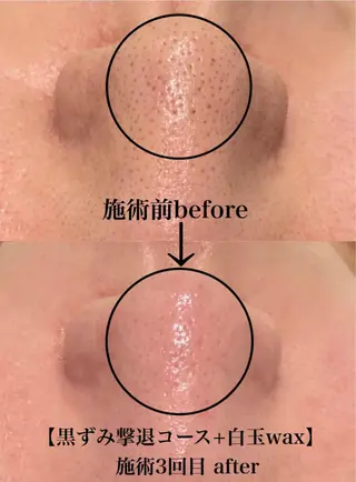 韓国肌管理 【毛穴専科】のエステ・リラクイメージ