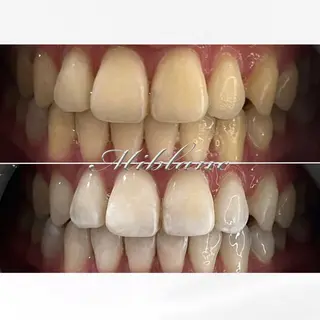 ホワイトニング MIBLANC上野店のその他イメージ