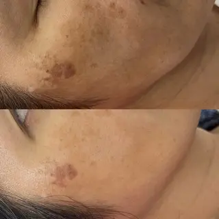 デ・アイム心斎橋所属・肌質改善サロン🫧 MAIのエステ・リラクイメージ