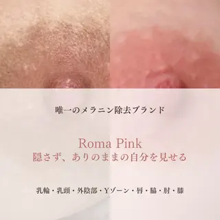 小顔/たるみ/黒ずみ除去専門サロン/SONA 大和西大寺店所属・【小顔専門看護師 サロンSONA】のエステ・リラクイメージ