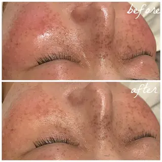 メンズ メナード岐阜茜部 杉浦のエステ・リラクイメージ