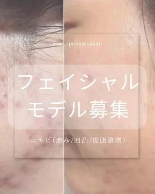 肌質改善|天王寺 For...はるかのエステ・リラクイメージ