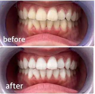 エクシアホワイト 立川南口のエステ・リラクイメージ