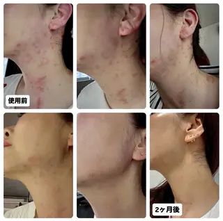 Binosu所属・エンダモロジー BINOSUのエステ・リラクイメージ