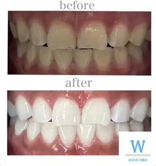 ホワイトニング ショップ本八幡店のエステ・リラクイメージ