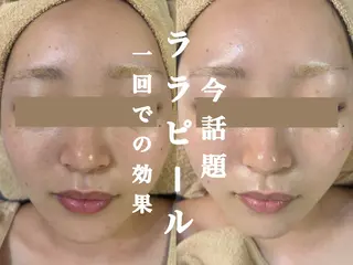 WHITE AQUA 北千住店のエステ・リラクイメージ