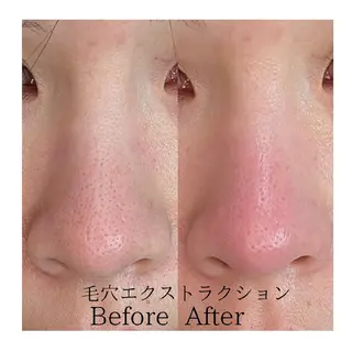  毛穴洗浄・まつ毛 の専門店 ソラーレのエステ・リラクイメージ